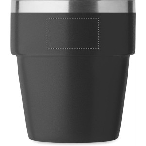 PARTE ANTERIORE SUPERIORE